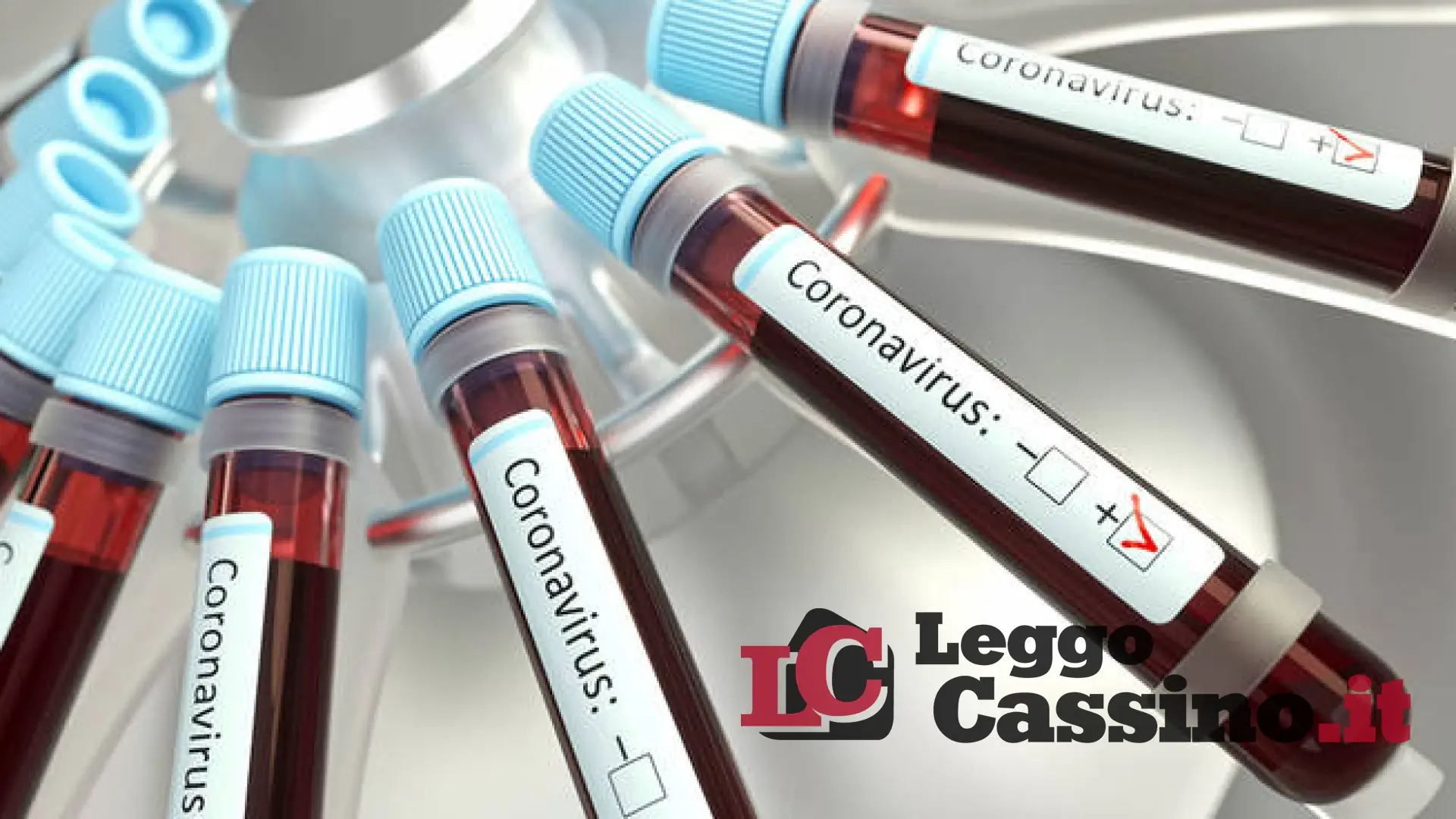 Covid, scoppia un focolaio alla Rsa "Villa degli Ulivi" di Sant'Elia