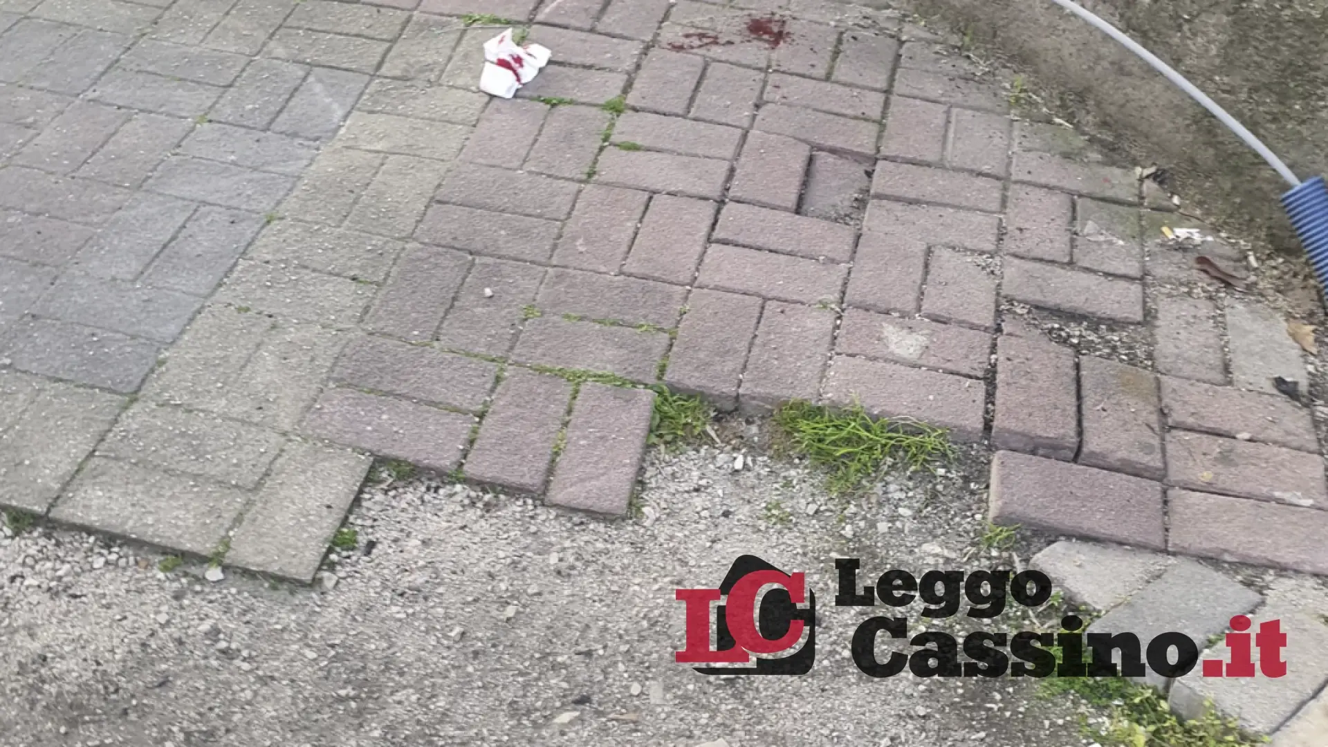 Cassino, inciampa sul marciapiede e finisce in ospedale: dieci giorni di prognosi