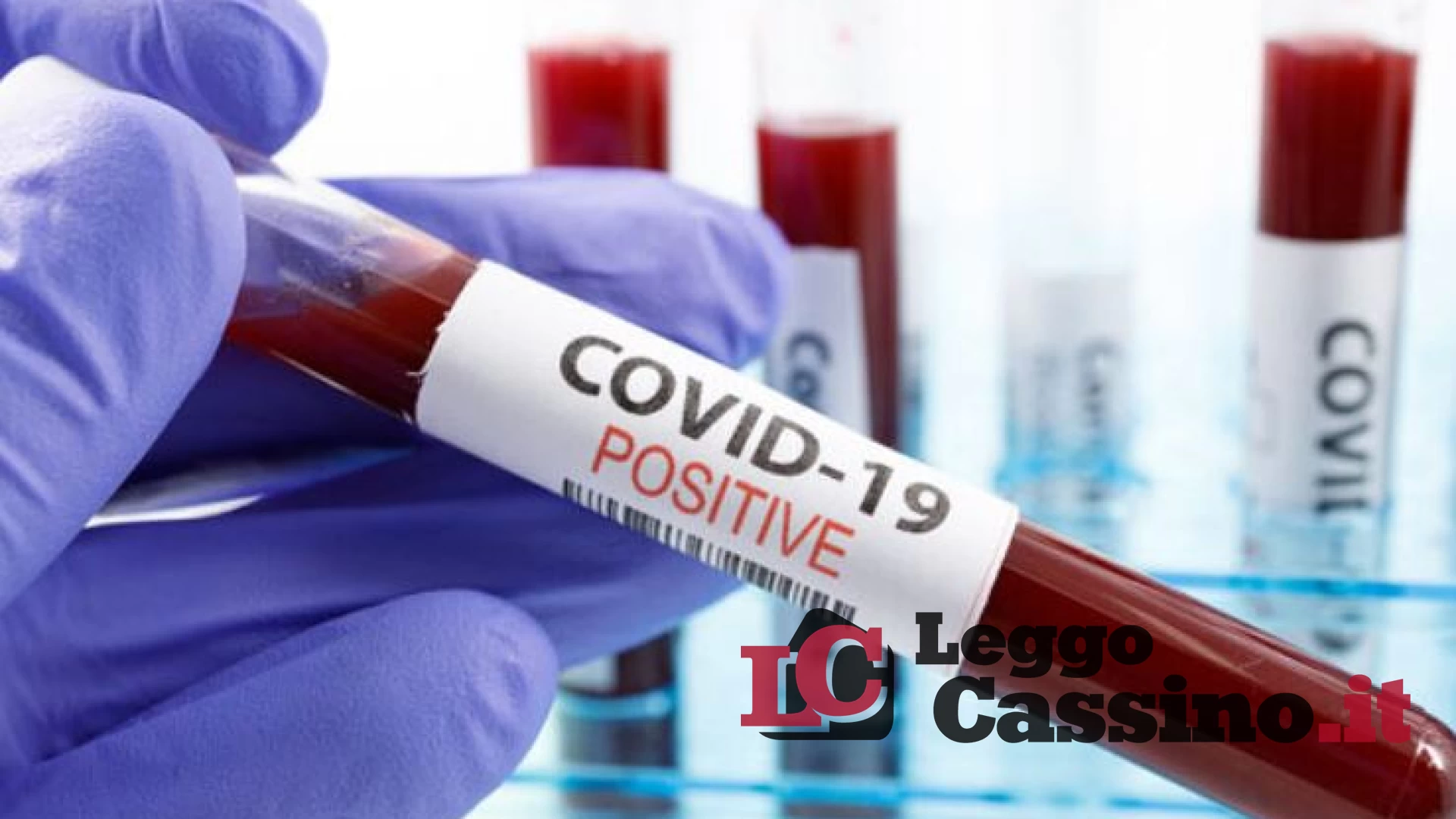 Covid, meno di duecento positivi e quasi seicento guariti